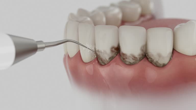 Reliable Emergency Dentist contractor in Pine Lawn, MO by Smile Center Dentistry
